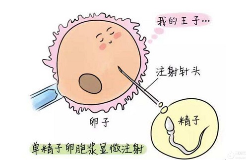 3次促排和3次移植都没有着床，怎么办？美国试管专家建议